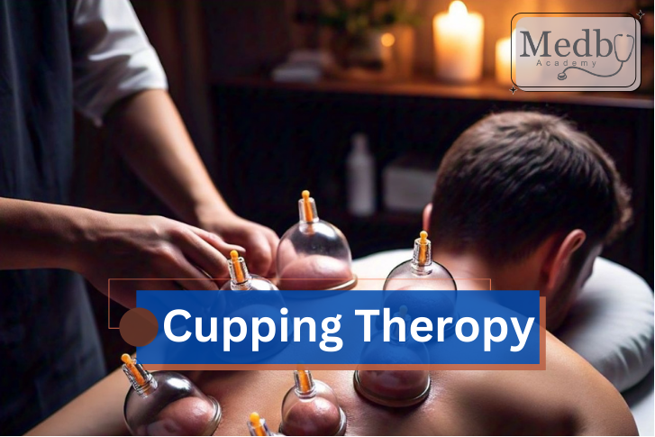 Cupping Theropy